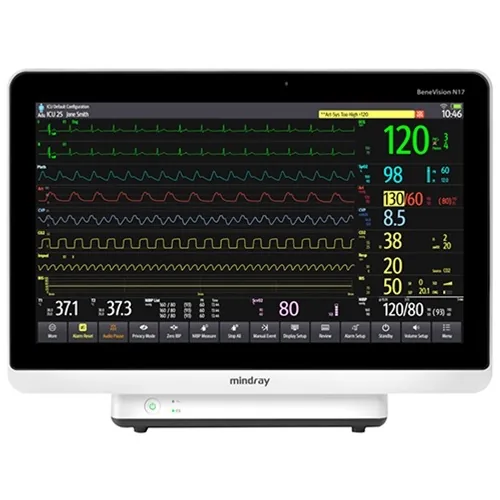 Mindray BeneVision N17 Patient Monitor